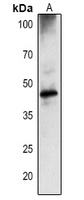 DEGP1 Rabbit Polyclonal Antibody