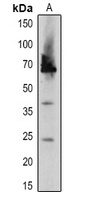 DEGP2 Rabbit Polyclonal Antibody