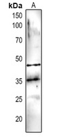 DEGP5 Rabbit Polyclonal Antibody