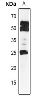 HSP25.3 Rabbit Polyclonal Antibody