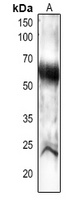 PEX14 Rabbit Polyclonal Antibody