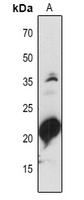 PSAD1/2 Rabbit Polyclonal Antibody