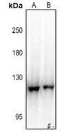 EPHB3 Rabbit Polyclonal Antibody