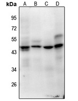 Histone H1oo (Acetyl-K163) Rabbit Polyclonal Antibody