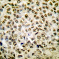Histone H1oo (Acetyl-K163) Rabbit Polyclonal Antibody