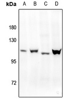 Progesterone Receptor (Phospho-S400) Rabbit Polyclonal Antibody