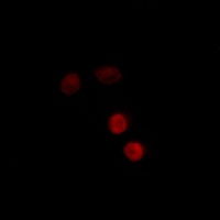 Progesterone Receptor (Phospho-S400) Rabbit Polyclonal Antibody