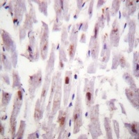 c-RAF (Phospho-S621) Antibody