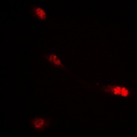 c-RAF (Phospho-S621) Antibody