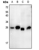 Thymidine Kinase 1 (Phospho-S13) Rabbit Polyclonal Antibody