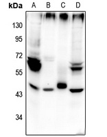 Beta-2 Adrenergic Receptor (Phospho-S355/S356) Rabbit Polyclonal Antibody