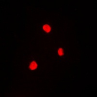 RB1 (Phospho-T821) Antibody