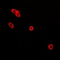 CD226 (Phospho-S329) Antibody