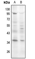 Cyclin D1 (Phospho-S90) Antibody