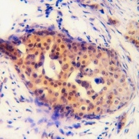 Cyclin D1 (Phospho-S90) Antibody