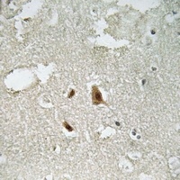 SMAD2 (Phospho-T220) Antibody
