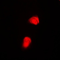 SMAD2 (Phospho-T220) Antibody
