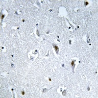 HMGN2 (Phospho-S29) Rabbit Polyclonal Antibody