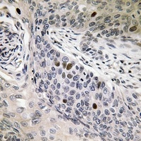 hnRNP D0 (Phospho-S83) Antibody