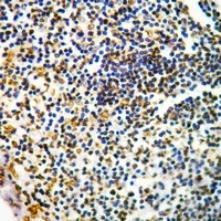 CD127 (Phospho-Y449) Antibody