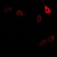 CD127 (Phospho-Y449) Antibody