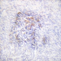 Aconitase 1 (Phospho-S138) Antibody