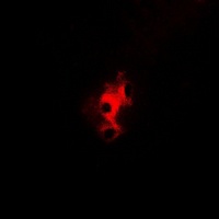 Aconitase 1 (Phospho-S138) Antibody