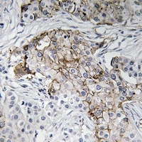 Beta-NaCH (Phospho-T615) Antibody