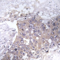 JAK2 (Phospho-Y221) Antibody