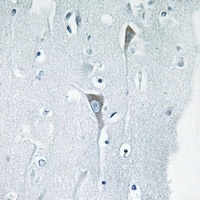JNK1/2/3 (Phospho-Y185) Rabbit Polyclonal Antibody