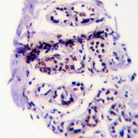 EGFR (Phospho-Y1110) Rabbit Polyclonal Antibody
