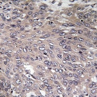 IP3R Rabbit Polyclonal Antibody