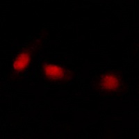 ATRX Rabbit Polyclonal Antibody