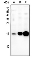 BLCAP Rabbit Polyclonal Antibody