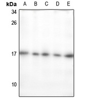 ECRG4 Rabbit Polyclonal Antibody