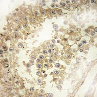 ECRG4 Rabbit Polyclonal Antibody