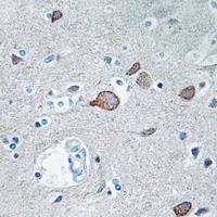 CEND1 Rabbit Polyclonal Antibody