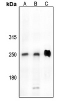 CDK5RAP2 Rabbit Polyclonal Antibody
