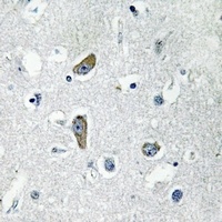 CDK5RAP2 Rabbit Polyclonal Antibody