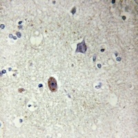 Collagen 4 alpha 3 Antibody