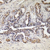 ATP5D Rabbit Polyclonal Antibody