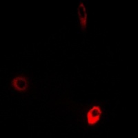 ATP5D Rabbit Polyclonal Antibody