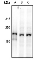 DOCK2 Rabbit Polyclonal Antibody