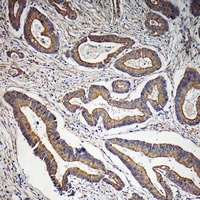 DOCK2 Rabbit Polyclonal Antibody
