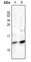 POLR2J Rabbit Polyclonal Antibody