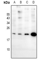 EIF1AY Rabbit Polyclonal Antibody
