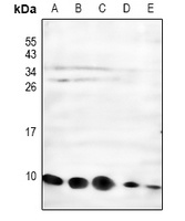 NDUFC1 Rabbit Polyclonal Antibody
