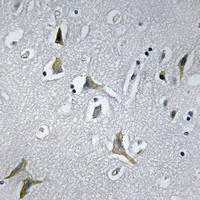 NDUFC1 Rabbit Polyclonal Antibody