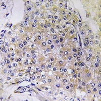 NDUFS6 Rabbit Polyclonal Antibody