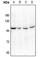 SSH3 Rabbit Polyclonal Antibody